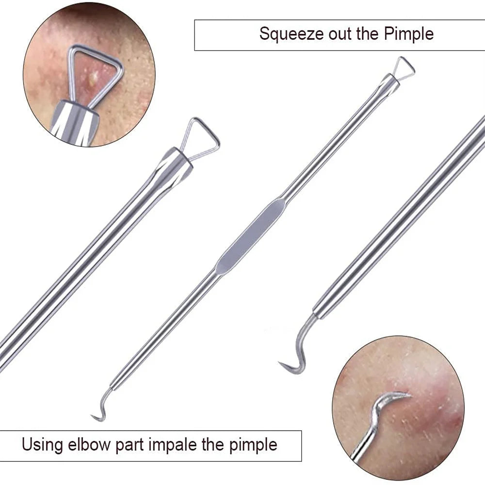 Stainless Steel Acne Removal Tool