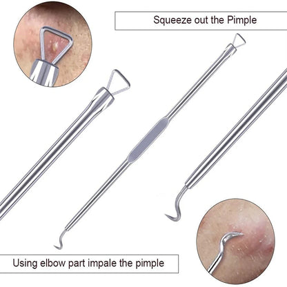 Stainless Steel Acne Removal Tool